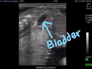 ultrasound-bladder